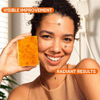 5 Pack Turmeric Kojic Acid Soap Bars(80G) - Infused with Retinol, Hydrolyzed Collagen, Vitamin E & Shea Butter, Gentle Care for Face, Body & Underarms, SLS Free, Suitable for Oily & Dry Skin